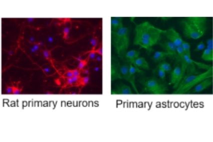 Primary neurons